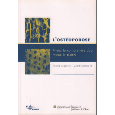 L'ostéoporose : mieux la comprendre pour mieux la traiter