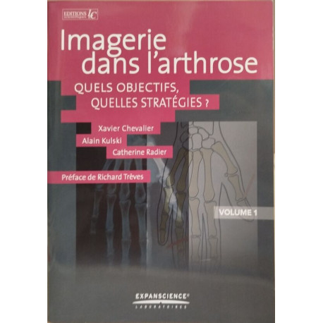 Imagerie dans l'arthrose quels objectifs quelles strategies ?/...